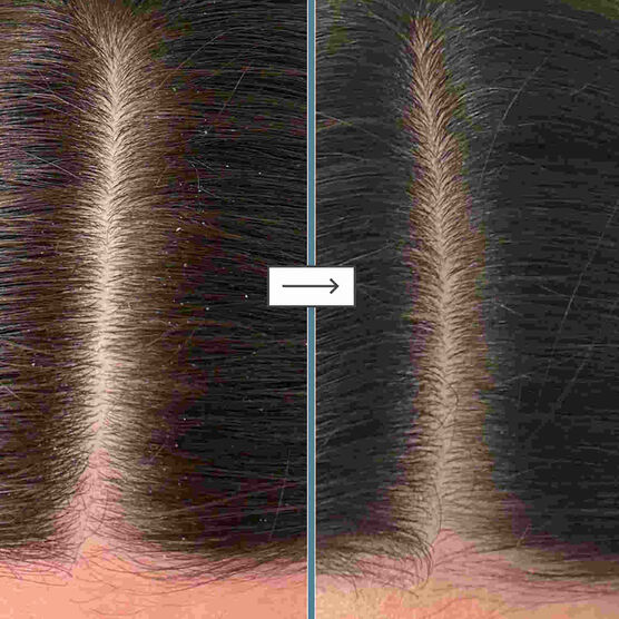 &Oacute;leo Capilar Briogeo Scalp Revival Rosemary Pre-Wash